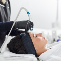 Aquapeel facial treatment 